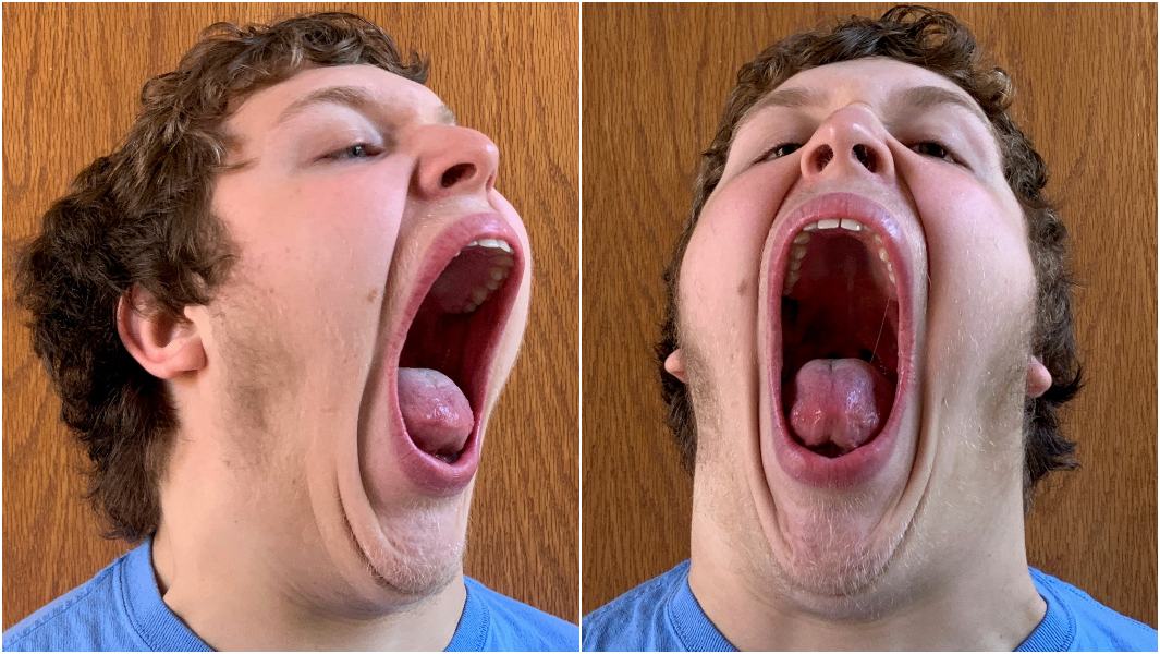 record-for-largest-mouth-gape.jpg