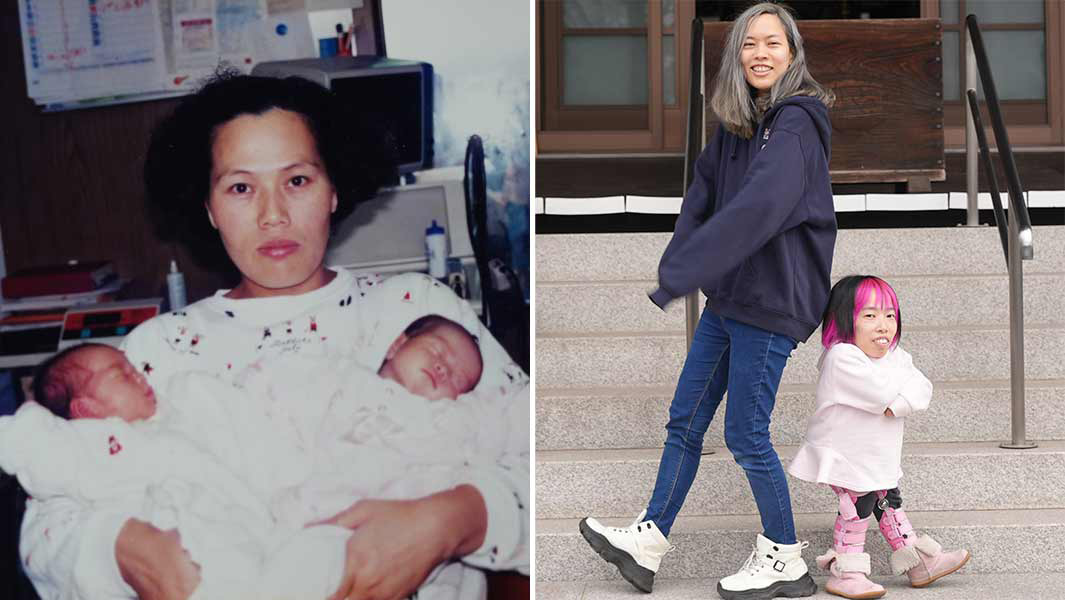 twins height difference split